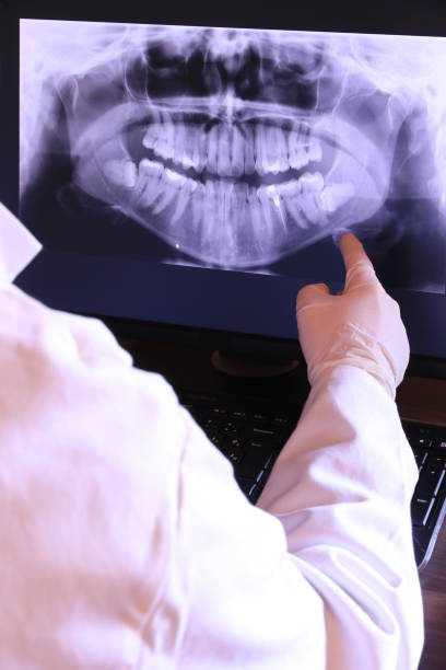 Best Emergency Gum Treatment in Mission, OR